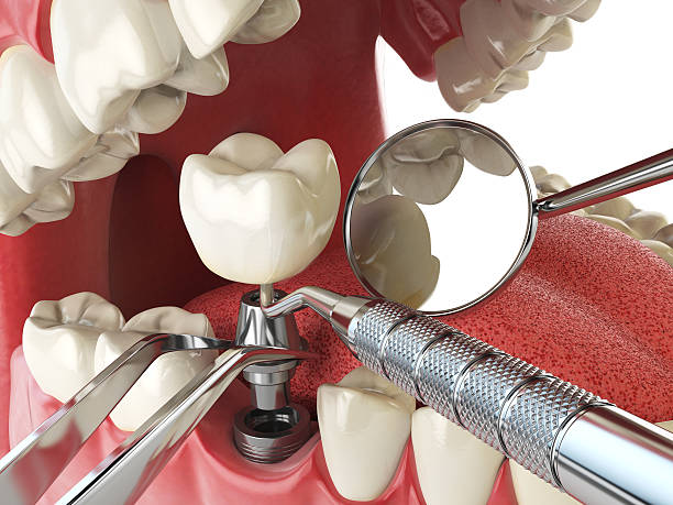 Best Same-Day Emergency Dental Services in Chamberlayne, VA